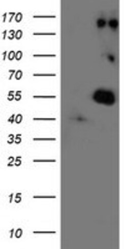 OriGene LOX Mouse Monoclonal Antibody [Clone ID: OTI9G2], Quantity: Each