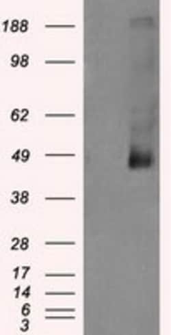 OriGene LOX Mouse Monoclonal Antibody [Clone ID: OTI3C3], Quantity: Each