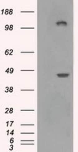 OriGene LOX Mouse Monoclonal Antibody [Clone ID: OTI5C4], Quantity: Each