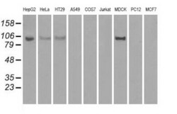 OriGene Hexokinase II (HK2) Mouse Monoclonal Antibody [Clone ID: OTI4C5],