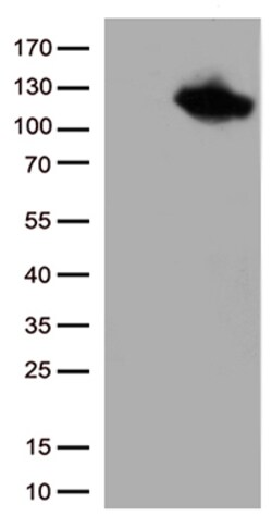 OriGene B Raf (BRAF) Mouse Monoclonal Antibody [Clone ID: OTI1D4], Quantity: