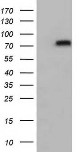 OriGene Transferrin (TF) Mouse Monoclonal Antibody [Clone ID: OTI5G2],