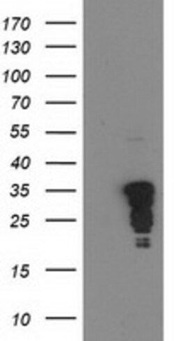 OriGene c-Jun (JUN) Mouse Monoclonal Antibody [Clone ID: OTI3G2], Quantity: