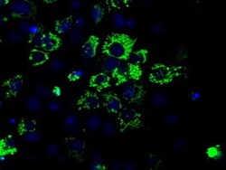 OriGene Aconitase 2 (ACO2) Mouse Monoclonal Antibody [Clone ID: OTI7A11],