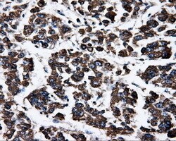 OriGene ATP5F1B Mouse Monoclonal Antibody [Clone ID: OTI1B10], Quantity: