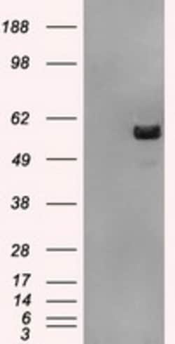 OriGene ATP5F1B Mouse Monoclonal Antibody [Clone ID: OTI3H8], Quantity: