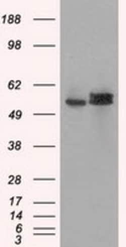 OriGene ATP5F1B Mouse Monoclonal Antibody [Clone ID: OTI6C4], Quantity: