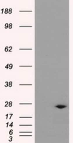 OriGene DCXR Mouse Monoclonal Antibody [Clone ID: OTI9C9], Quantity: Each