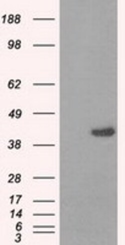 OriGene PPME1 Mouse Monoclonal Antibody [Clone ID: OTI10A12], Quantity: