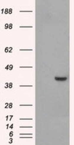 OriGene PPME1 Mouse Monoclonal Antibody [Clone ID: OTI4A12], Quantity:
