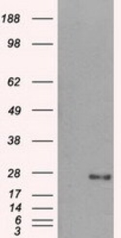OriGene&nbsp;DCXR Mouse Monoclonal Antibody [Clone ID: OTI4D11]