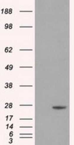 OriGene DCXR Mouse Monoclonal Antibody [Clone ID: OTI4H10], Quantity: Each