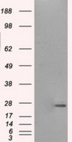 OriGene Prolactin (PRL) Mouse Monoclonal Antibody [Clone ID: OTI2C3], Quantity: