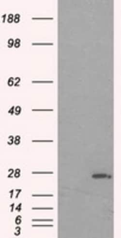 OriGene Prolactin (PRL) Mouse Monoclonal Antibody [Clone ID: OTI2E4], Quantity: