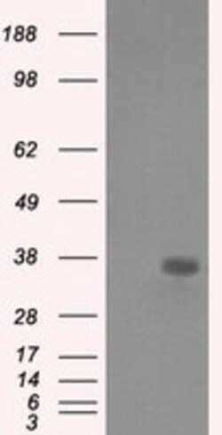 OriGene AKR1A1 Mouse Monoclonal Antibody [Clone ID: OTI4G6], Quantity: