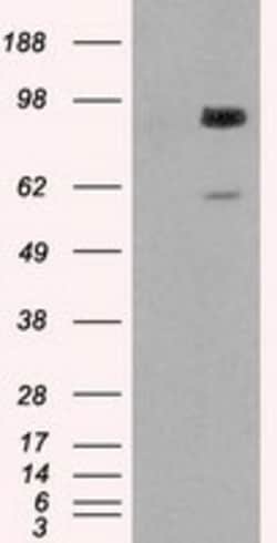 OriGene GBE1 Mouse Monoclonal Antibody [Clone ID: OTI4D9], Quantity: Each