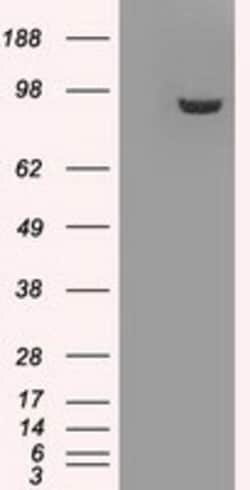 OriGene GBE1 Mouse Monoclonal Antibody [Clone ID: OTI3C8], Quantity: Each