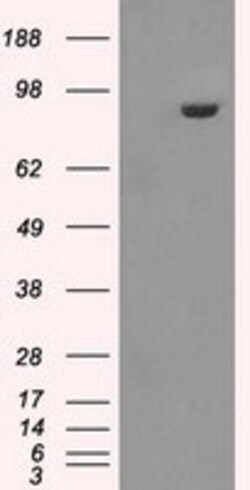 OriGene GBE1 Mouse Monoclonal Antibody [Clone ID: OTI5B7], Quantity: Each