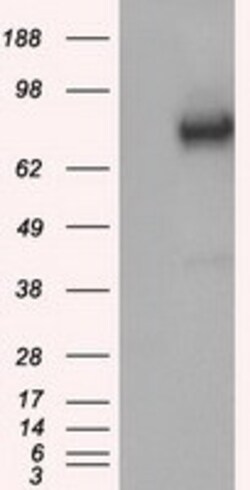 OriGene GBE1 Mouse Monoclonal Antibody [Clone ID: OTI3B4], Quantity: Each