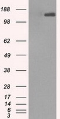 OriGene L1CAM Mouse Monoclonal Antibody [Clone ID: OTI4F4], Quantity: Each