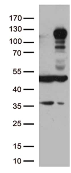 OriGene MAN1 (LEMD3) Mouse Monoclonal Antibody [Clone ID: OTI3H2], Quantity: