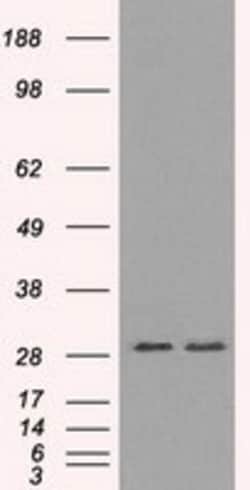 OriGene RPA34 (RPA2) Mouse Monoclonal Antibody [Clone ID: OTI7C12], Quantity: