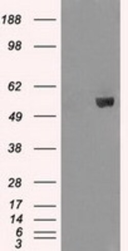 OriGene AKT2 Mouse Monoclonal Antibody [Clone ID: OTI8D9], Quantity: Each