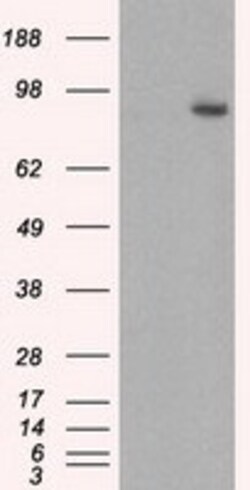 OriGene GBE1 Mouse Monoclonal Antibody [Clone ID: OTI4E6], Quantity: Each