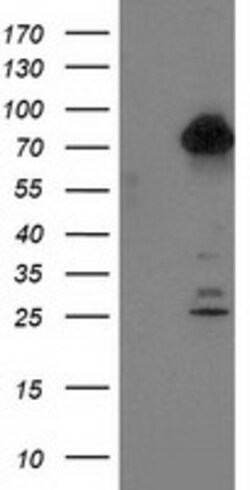 OriGene TTLL12 Mouse Monoclonal Antibody [Clone ID: OTI3H6], Quantity:
