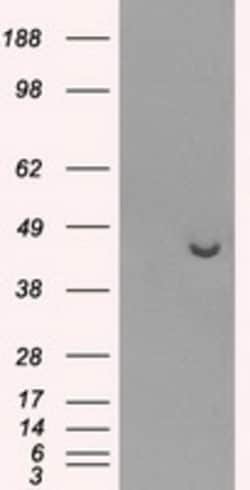 OriGene PPME1 Mouse Monoclonal Antibody [Clone ID: OTI2C5], Quantity: Each