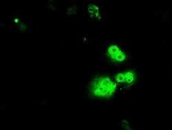 OriGene RPA34 (RPA2) Mouse Monoclonal Antibody [Clone ID: OTI1H10], Quantity: