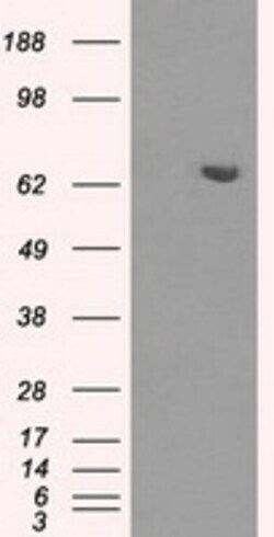 OriGene HDAC10 Mouse Monoclonal Antibody [Clone ID: OTI5A1], Quantity: