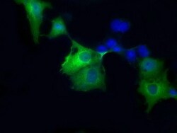 OriGene Sorbitol Dehydrogenase (SORD) Mouse Monoclonal Antibody [Clone