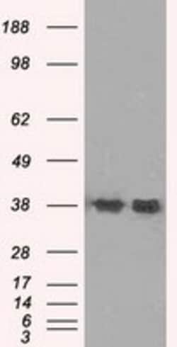 OriGene Sorbitol Dehydrogenase (SORD) Mouse Monoclonal Antibody [Clone