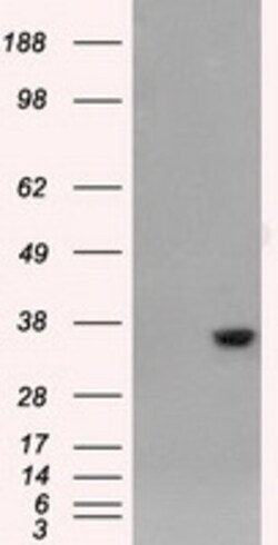 OriGene AKR1A1 Mouse Monoclonal Antibody [Clone ID: OTI4G2], Quantity: