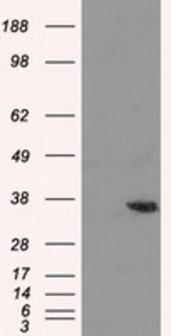 OriGene AKR1A1 Mouse Monoclonal Antibody [Clone ID: OTI6E3], Quantity: