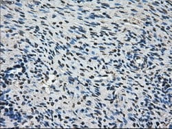 OriGene AKR1A1 Mouse Monoclonal Antibody [Clone ID: OTI10E11], Quantity: