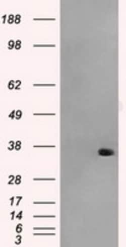 OriGene AKR1A1 Mouse Monoclonal Antibody [Clone ID: OTI8H2], Quantity: