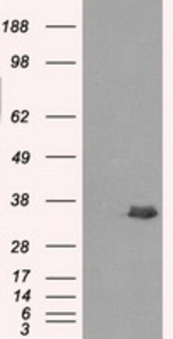 OriGene AKR1A1 Mouse Monoclonal Antibody [Clone ID: OTI2E7], Quantity: