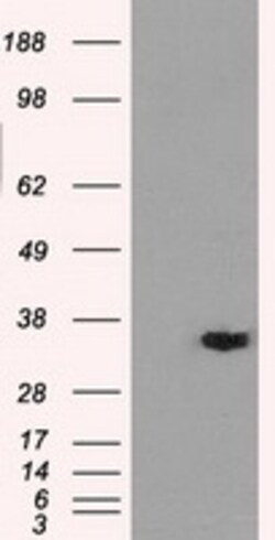 OriGene AKR1A1 Mouse Monoclonal Antibody [Clone ID: OTI9F1], Quantity: