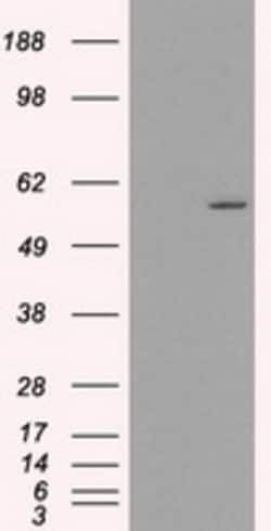 OriGene&nbsp;Cytochrome P450 2E1 (CYP2E1) Mouse Monoclonal Antibody [Clone ID: OTI9E6]