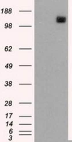 OriGene L1CAM Mouse Monoclonal Antibody [Clone ID: OTI2H5], Quantity: Each