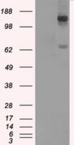 OriGene L1CAM Mouse Monoclonal Antibody [Clone ID: OTI2C7], Quantity: Each
