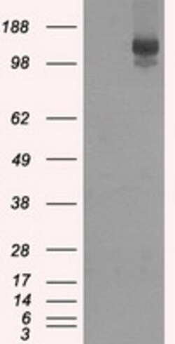 OriGene L1CAM Mouse Monoclonal Antibody [Clone ID: OTI2A6], Quantity: Each