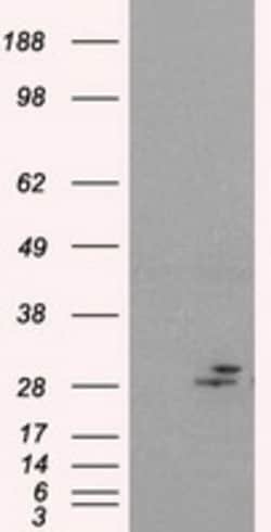 OriGene Prolactin (PRL) Mouse Monoclonal Antibody [Clone ID: OTI2B7], Quantity: