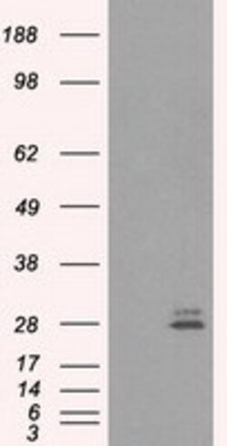 OriGene Prolactin (PRL) Mouse Monoclonal Antibody [Clone ID: OTI9D12],