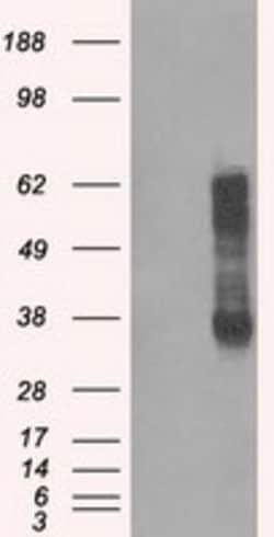 OriGene IBRDC2 (RNF144B) Mouse Monoclonal Antibody [Clone ID: OTI3D7],