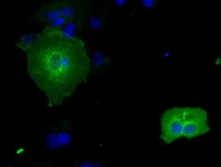 OriGene IBRDC2 (RNF144B) Mouse Monoclonal Antibody [Clone ID: OTI6B5],