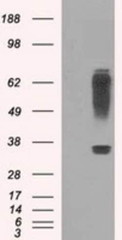 OriGene IBRDC2 (RNF144B) Mouse Monoclonal Antibody [Clone ID: OTI9H10],