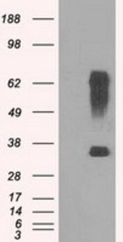 OriGene IBRDC2 (RNF144B) Mouse Monoclonal Antibody [Clone ID: OTI11F4],